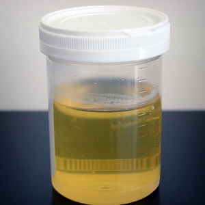 FB urine sample